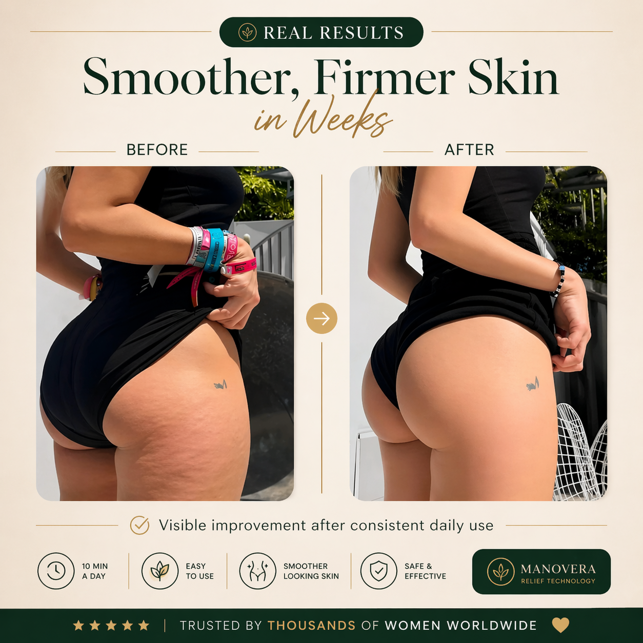 Manovera® Lymphatic Sculpt Roller
